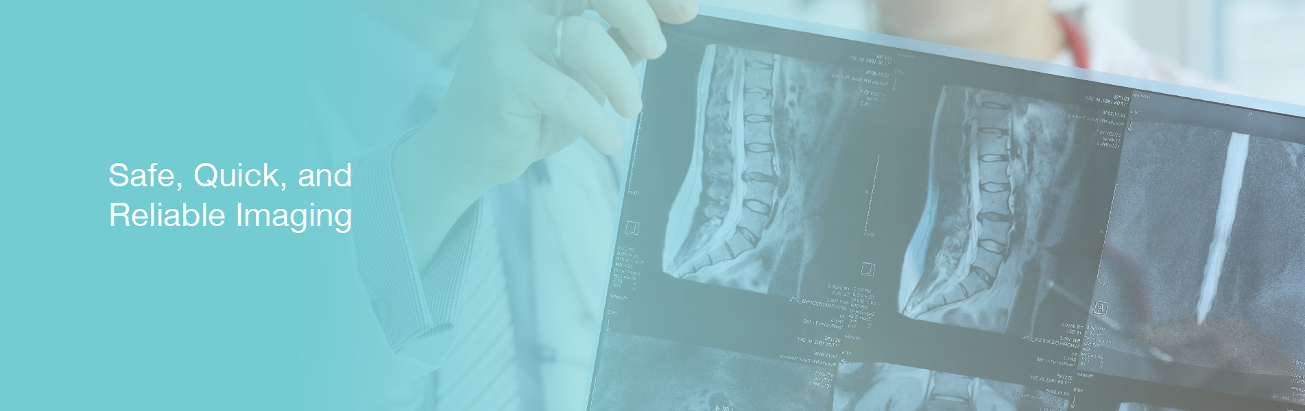 X-Ray